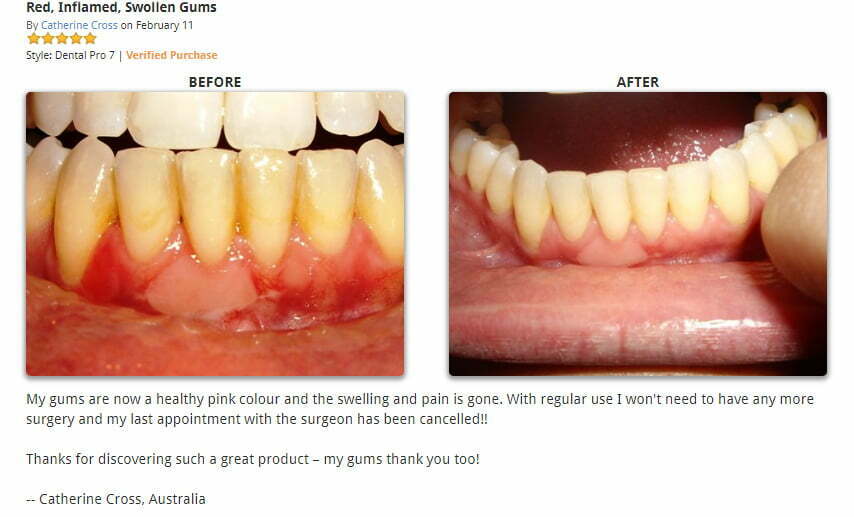Dental Pro 7 Red Gum