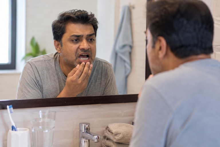 Advanced Periodontal Disease From Tartar