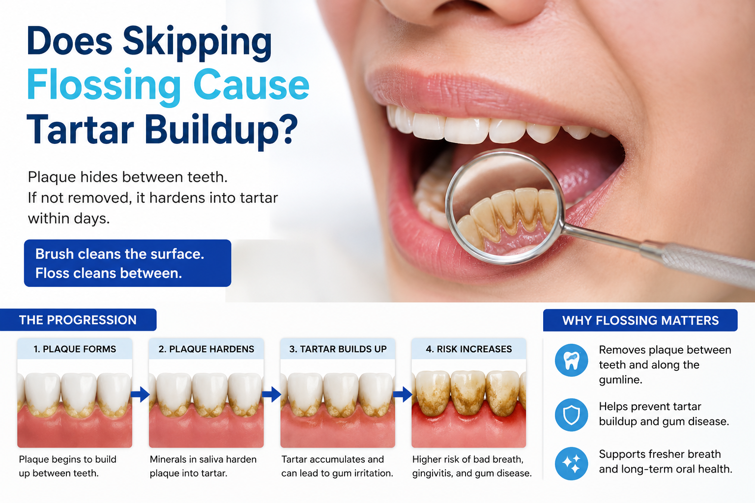 Does Skipping Flossing Cause Tartar Buildup