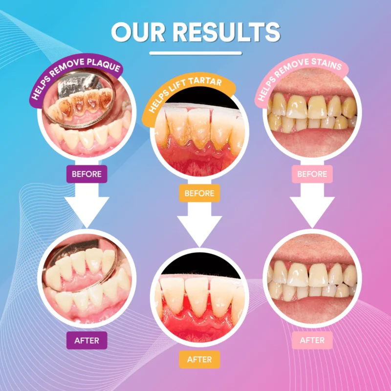 Best Home Dental Scaling Methods Guide