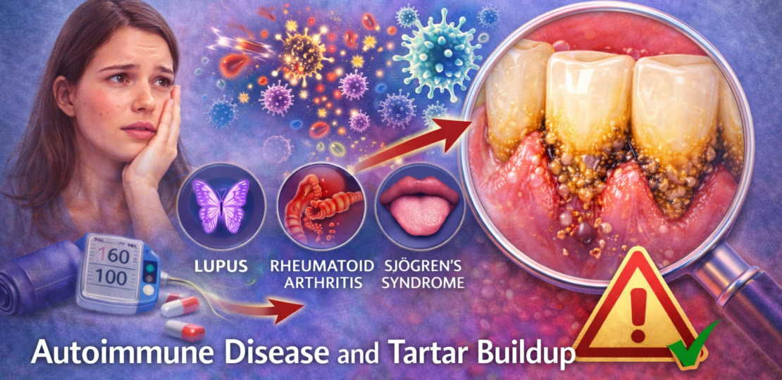Autoimmune Disease and Tartar Buildup