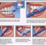 Common Oral Hygiene Mistakes That Harm Gums