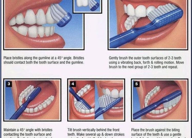 Common Oral Hygiene Mistakes That Harm Gums