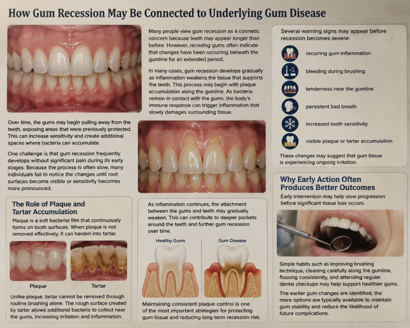 Receding Gums Treatment