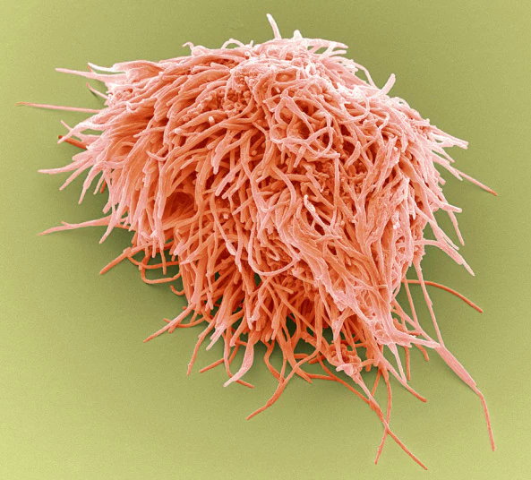 Tooth Decay Prevention for Healthier Teeth2