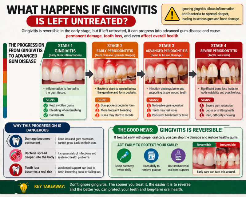 Gingivitis Treatment