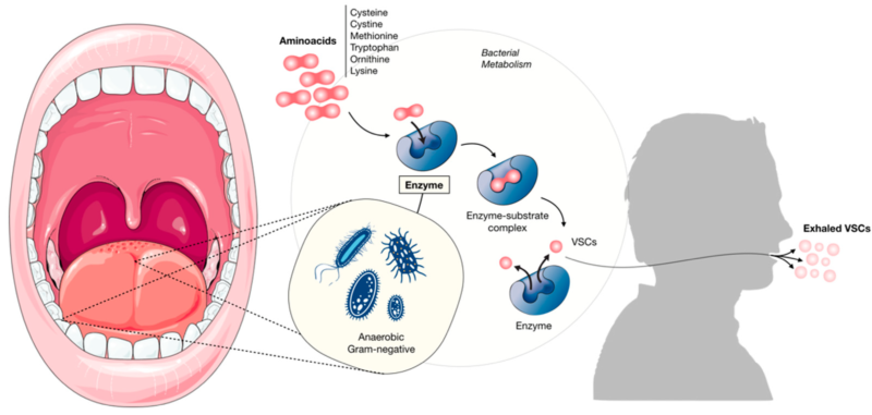 Best natural solution for bad breath gum problems